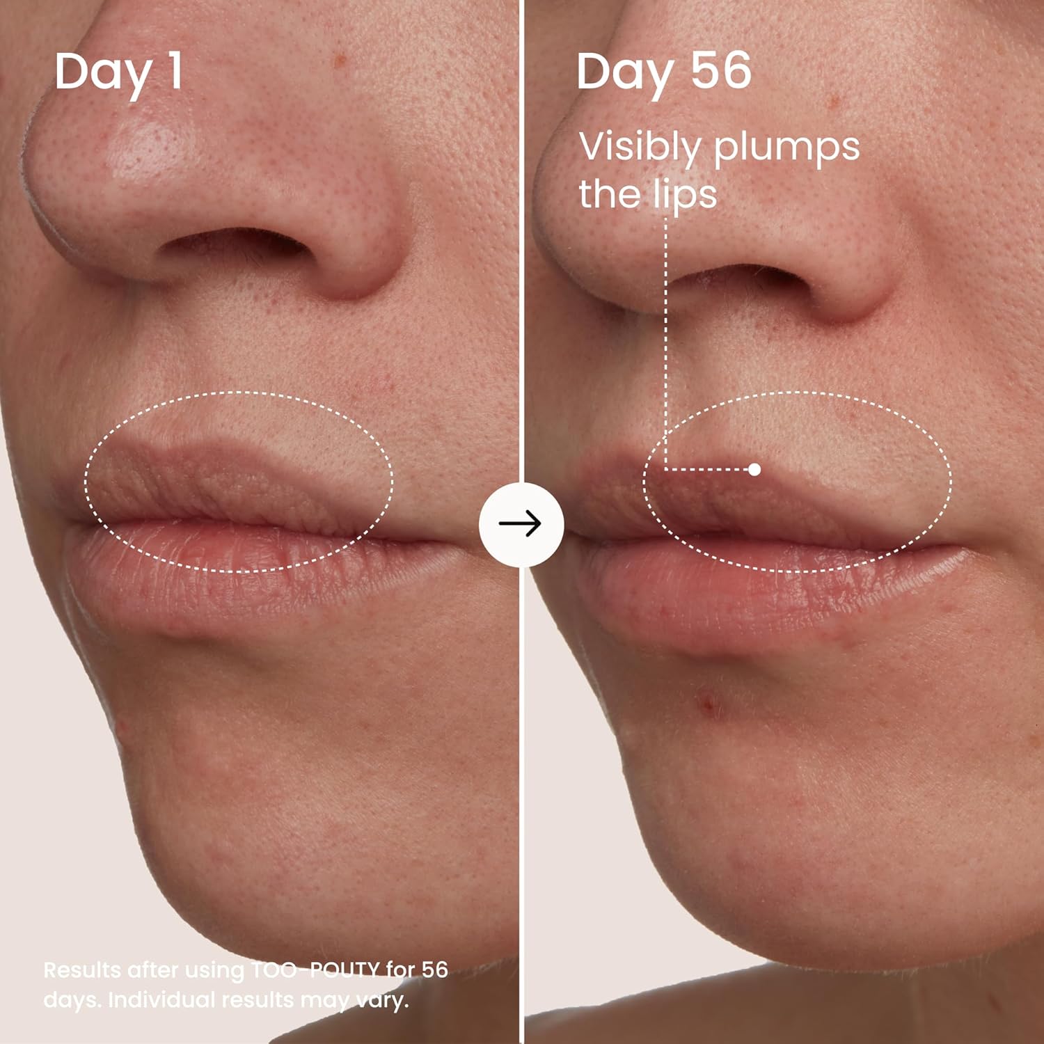 MAËLYS TOO-POUTY Lip Plumping Mask - Dual-Use Lip Treatment and Primer - Visibly Smooths Fine Lines and Enhances Fullness (0.5 Fl Oz)